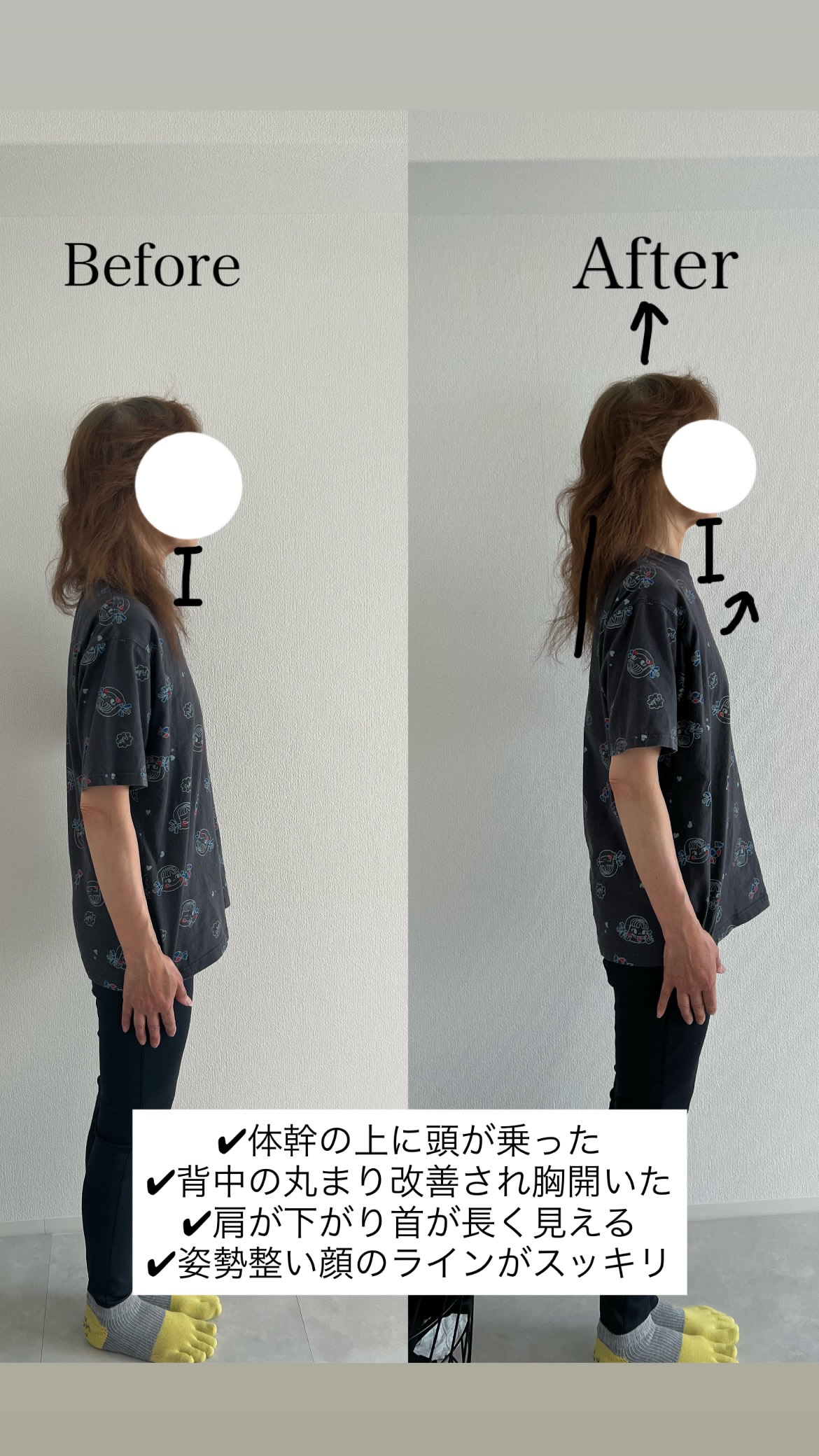 レッスン前後の正面の姿勢を比較した写真